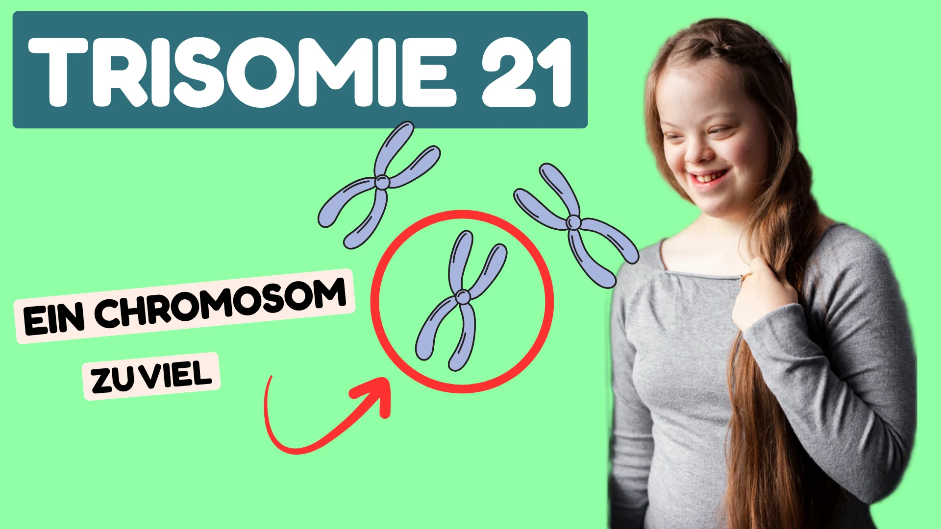 Down syndrom Trisomie 21 Down syndrom Trisomie 21